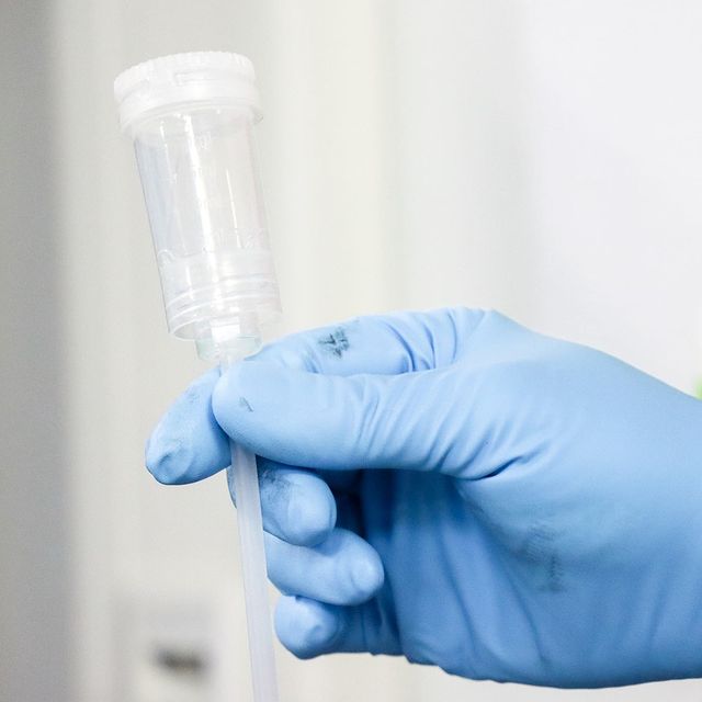 koch-chemie-dosing-cap-3 Koch Chemie Dosing Cap